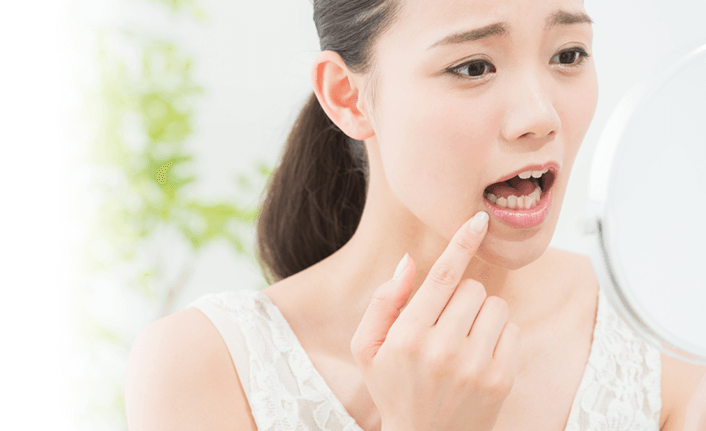 口の中を鏡で見る女性