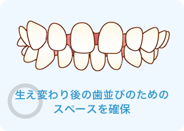 生え変わり後の歯並びのためのスペースを確保